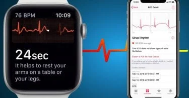apple watch fonction ecg watchos