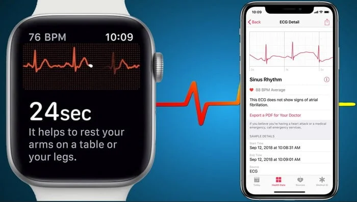 apple watch fonction ecg watchos